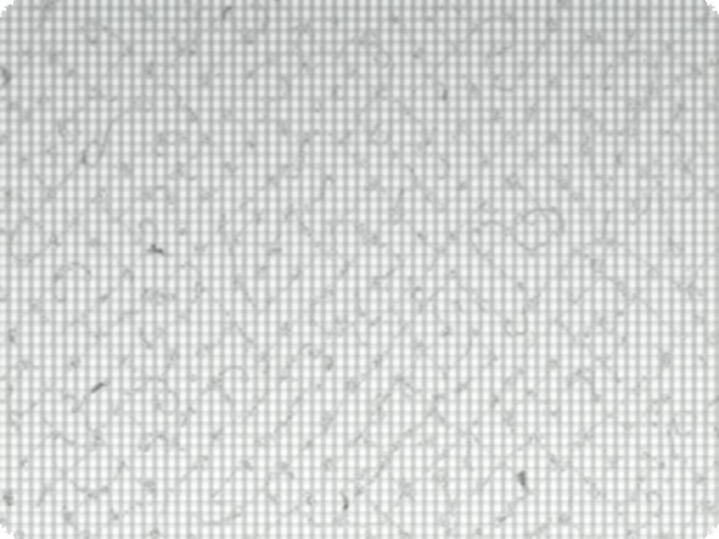 Couch Cushion Spring Replacement Zig Zag